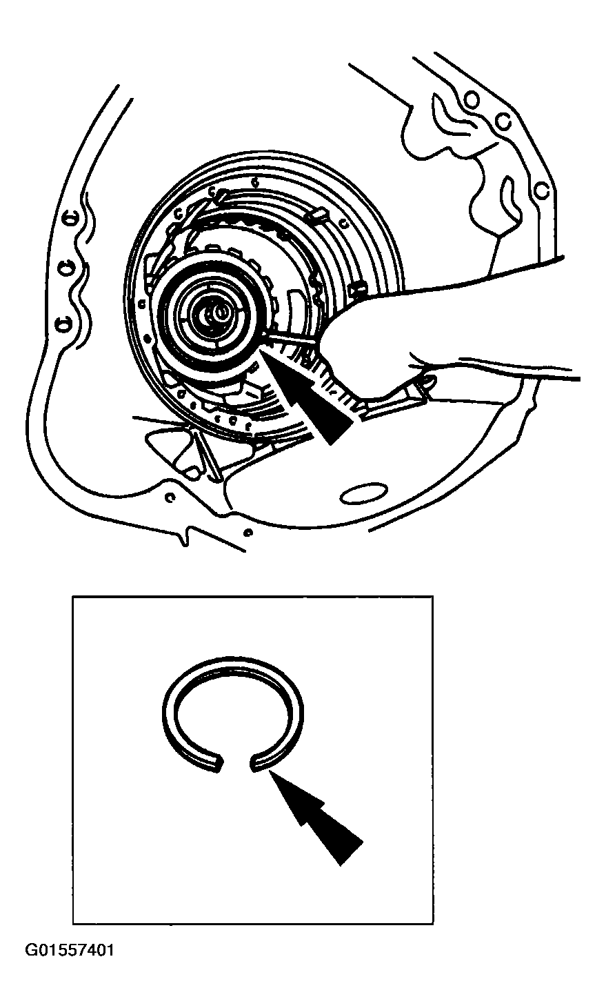 G01557401