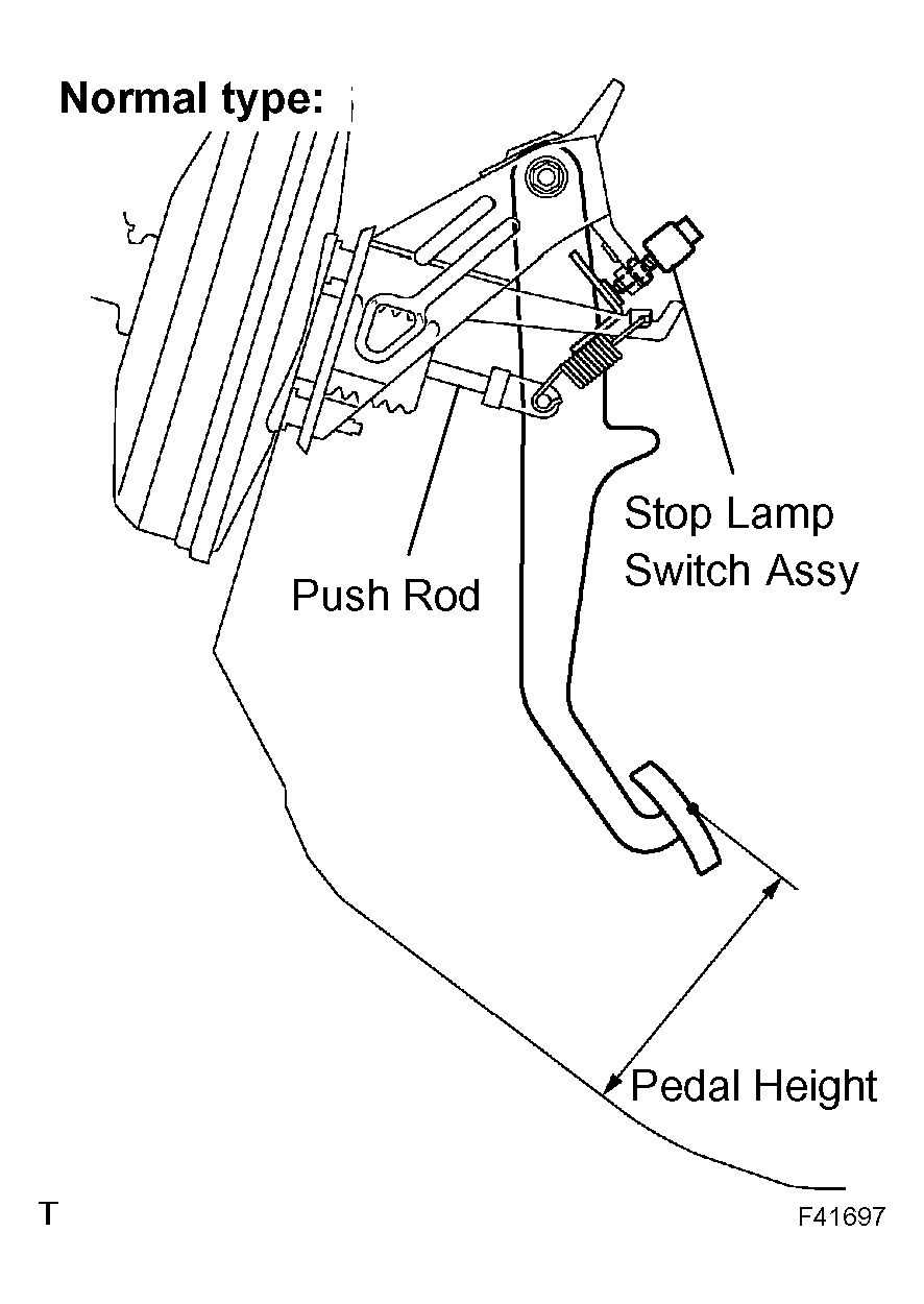 G04393041