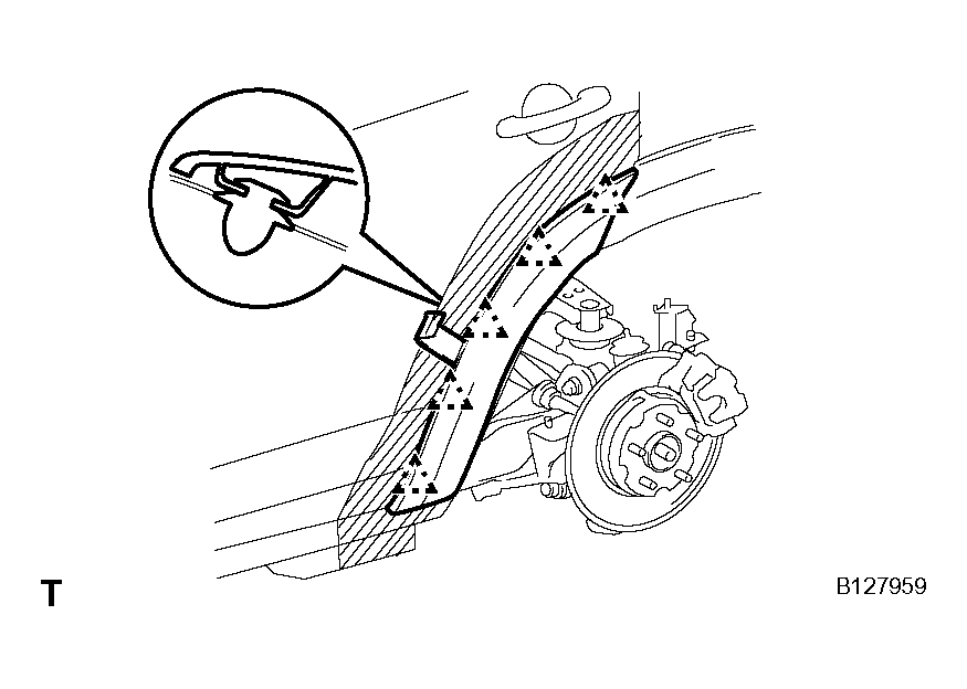 G04492315