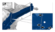 G14361000