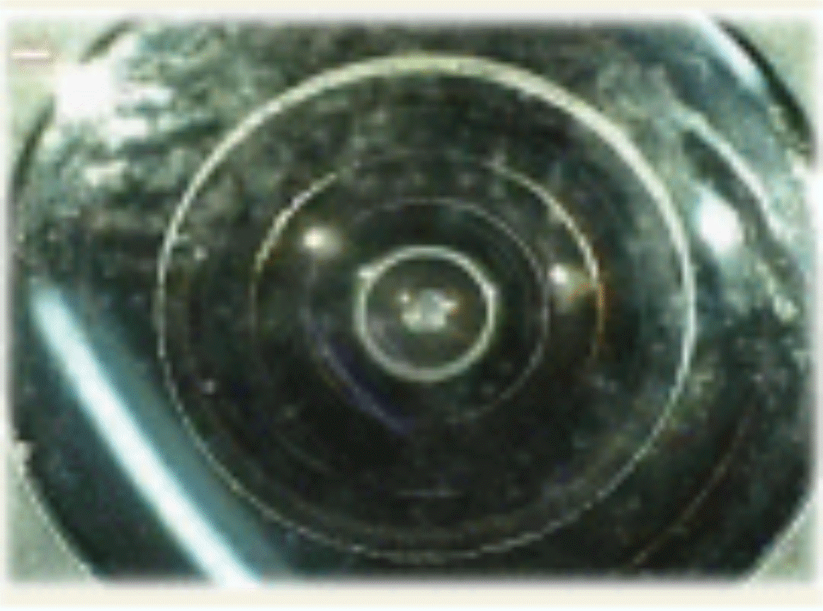 G15710764