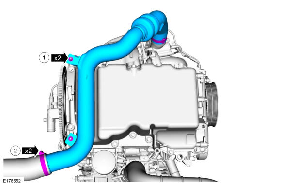 GFD394314