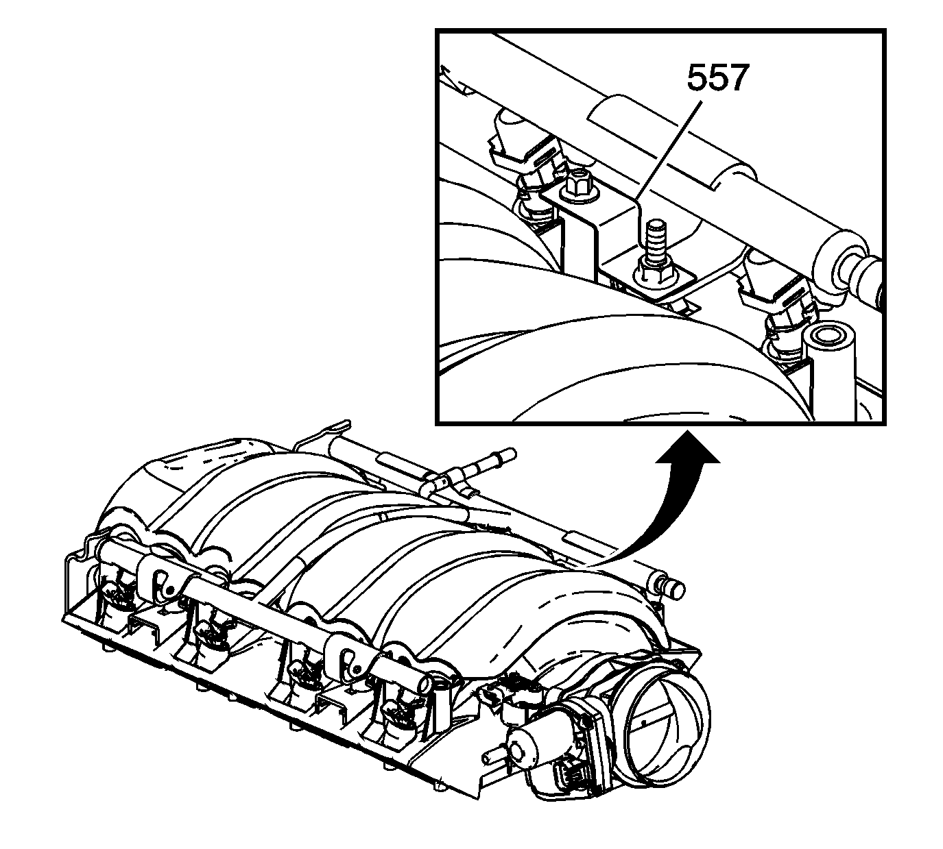 GM1876000
