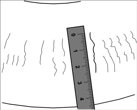 GP00010521