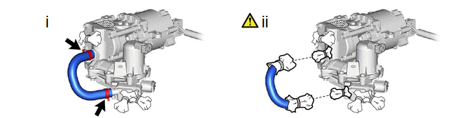 GTY1001645