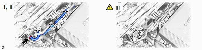 GTY1003515