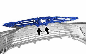 GTY1018225