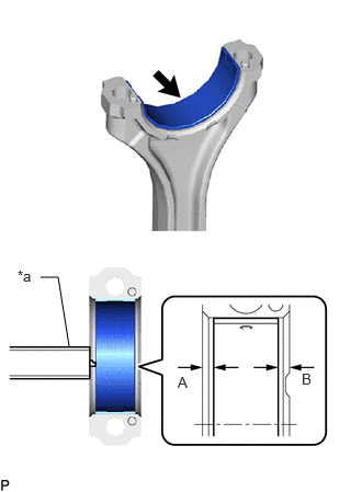GTY1019310
