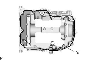 GTY1020135