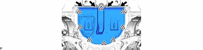 GTY1107420