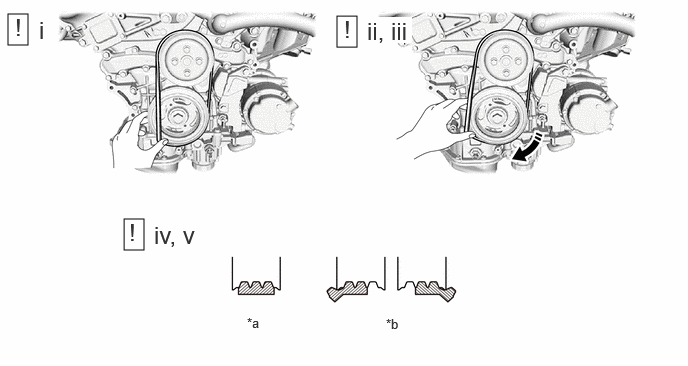 GTY1236260