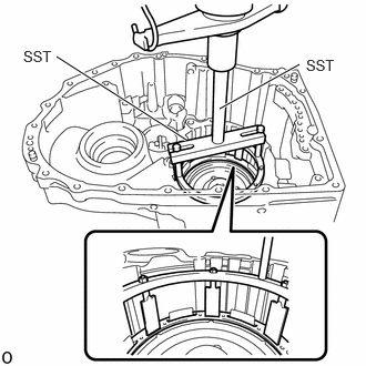 GTY1252151