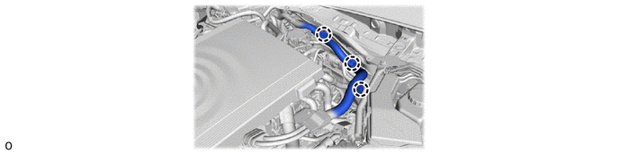 GTY992722