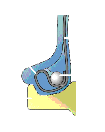 GWWA44-10042